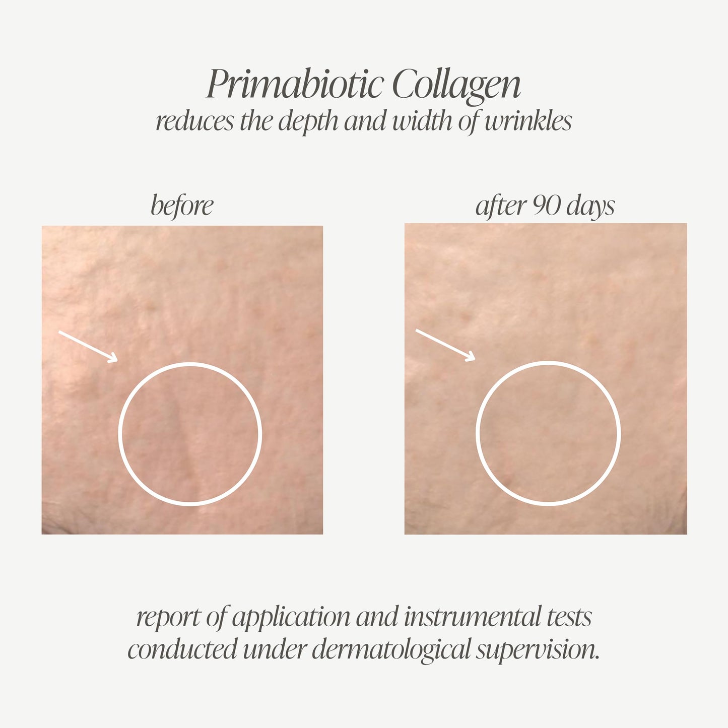 PRIMABIOTIC Liquid Collagen – 10,000 mg per Serving, Hydrolyzed Collagen + 12 Vitamins, Gluten Free, 900 ml (30 x 30 ml)