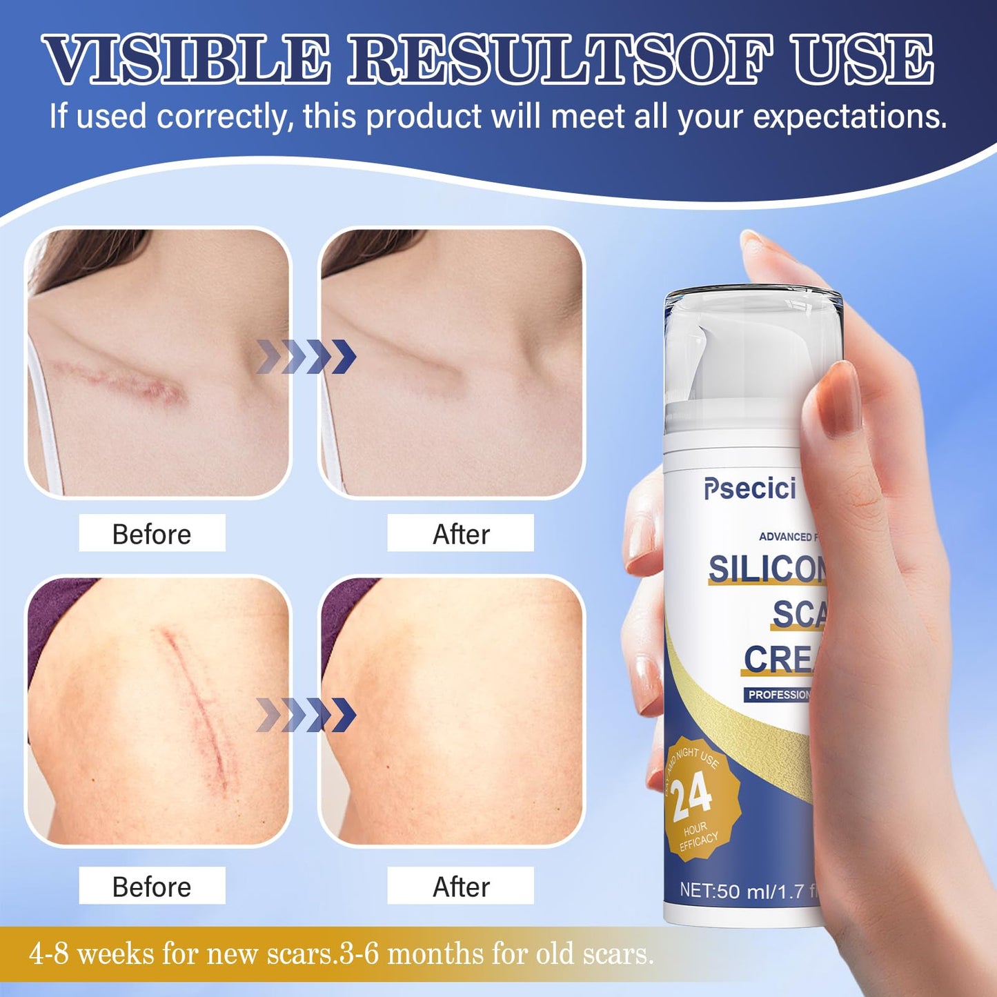 Psecici Silicone Scar Gel – Advanced Scar Cream (1.7 oz) for Surgical & Acne Scars