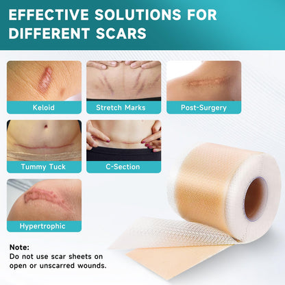 Pumkot Silicone Scar Sheets & Tape Roll – 1.8 x 157 inch for Surgical, C-Section, Burns