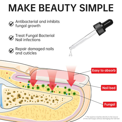 QQE Nail Fungus Treatment Extra Strength - 25% Undecylenic Acid