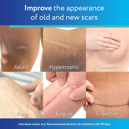 ScarAway Advanced Clear Silicone Scar Sheets (10 Count) – Medical-Grade Silicone Strips for Surgical, Burn, and Hypertrophic Scars