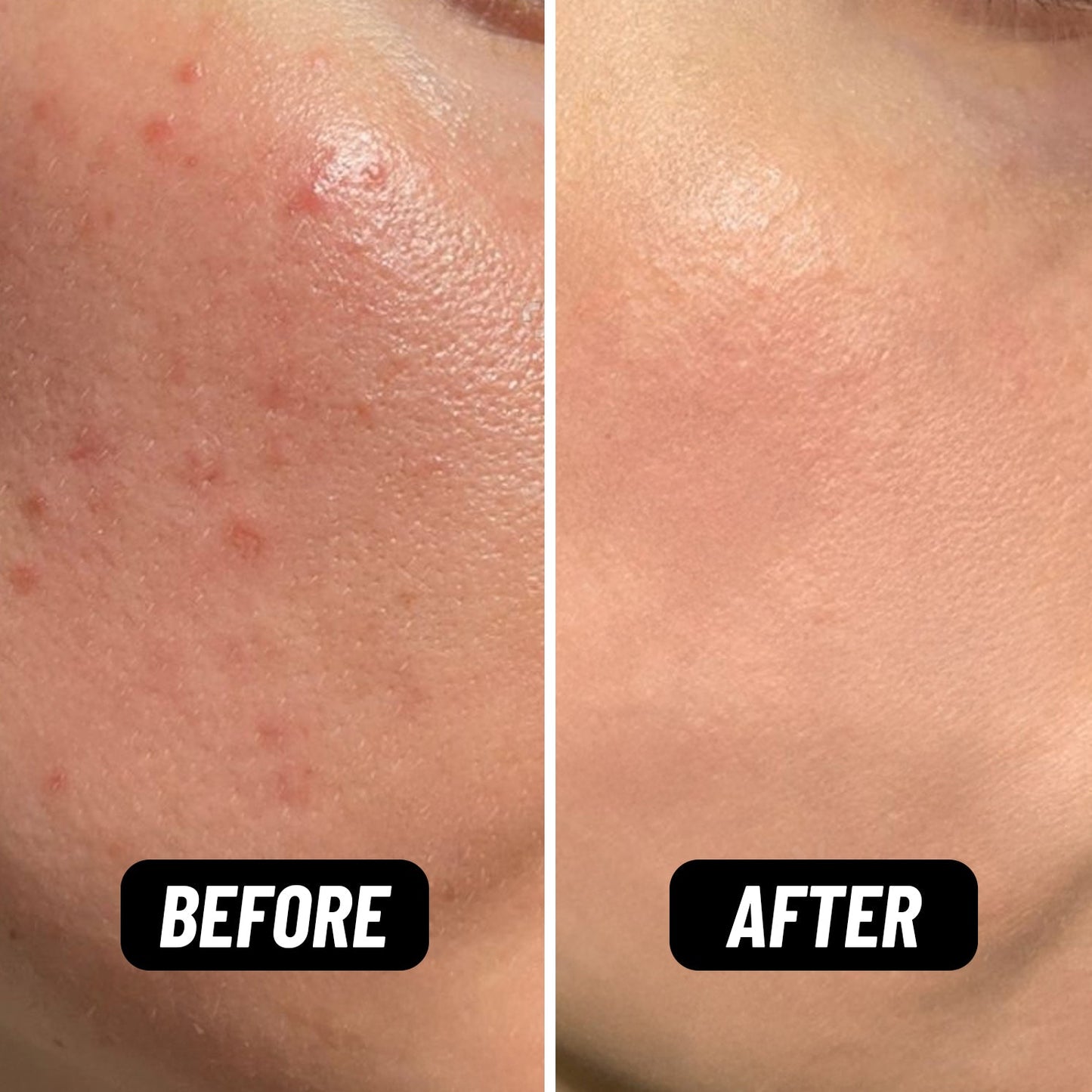 Shake It Up Facial Oil - HealVia LimitedHealVia LimitedShake It Up Facial Oil