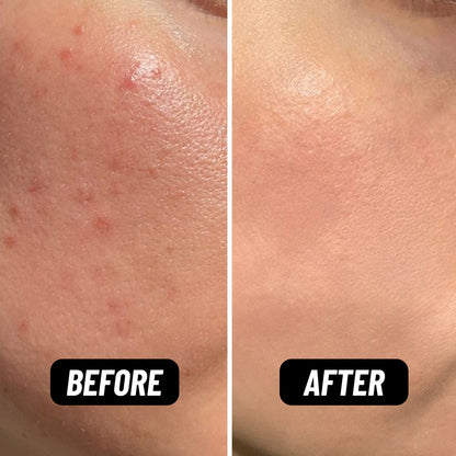 Shake It Up Facial Oil - HealVia LimitedHealVia LimitedShake It Up Facial Oil