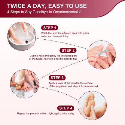 Sidinox Toenail Fungus Treatment Extra Strength with 25% Undecylenic Acid — 5 Pack