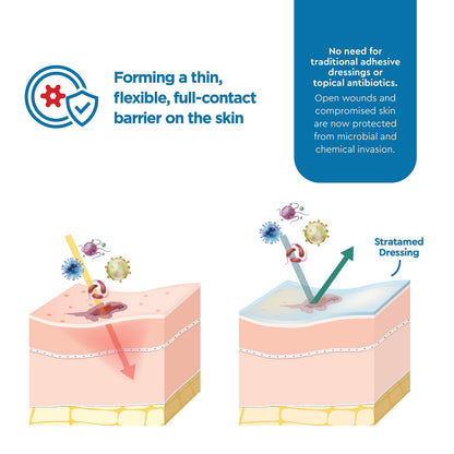 Stratamed Advanced Film-Forming Wound Dressing | Flexible Protective Layer for Wounds & Damaged Skin | 5g