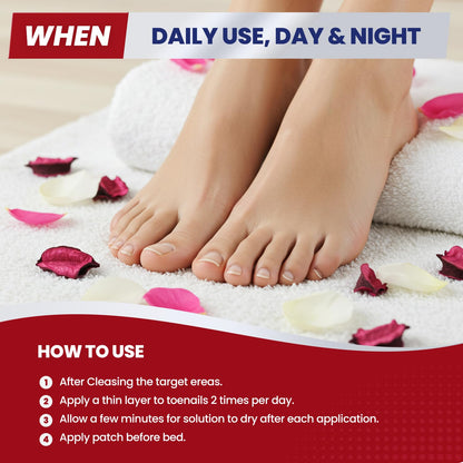 Treatonic Toenail Fungus Treatment Kit – Extra Strength 25% Undecylenic Acid + 32 Nighttime Patches
