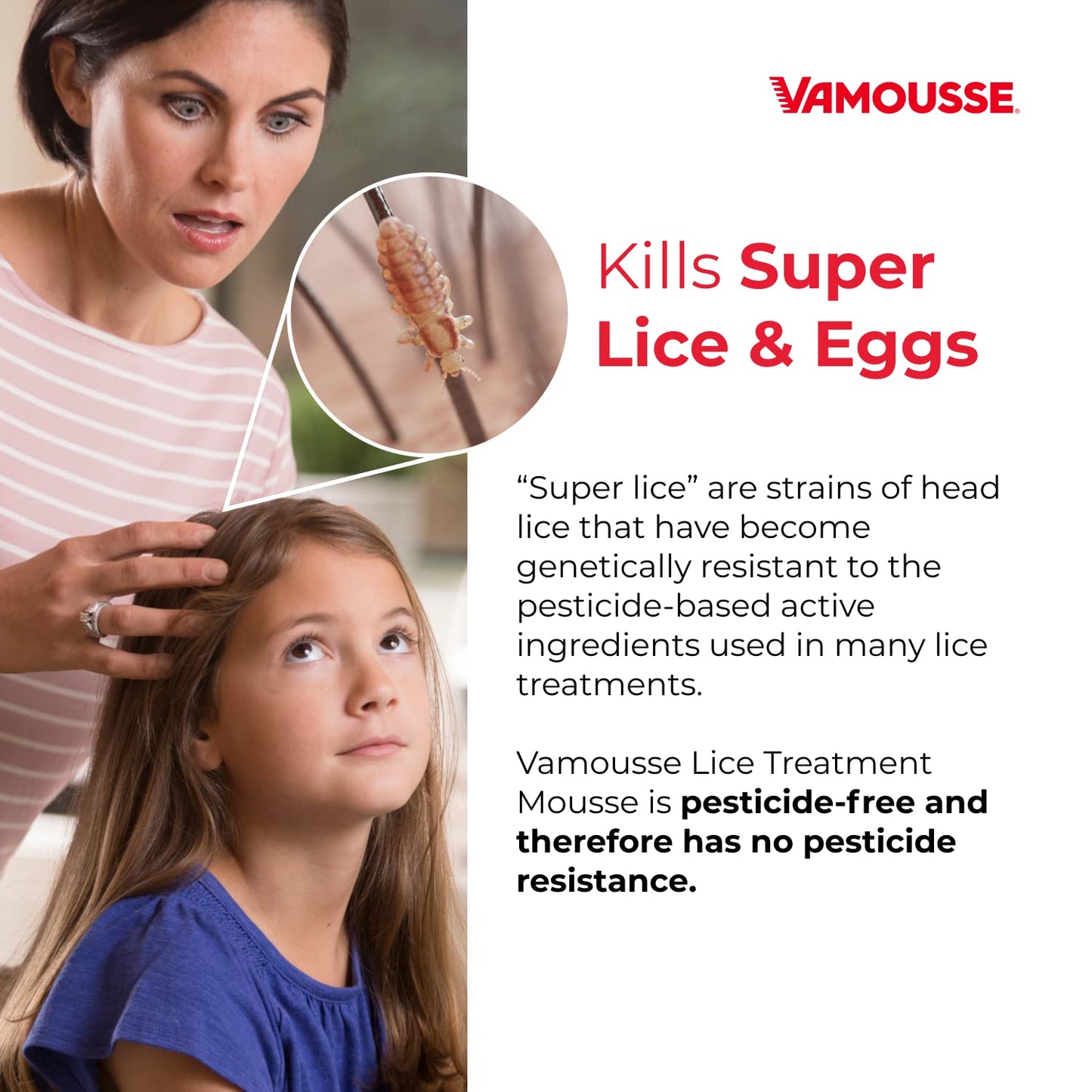 Vamousse Lice Emergency Kit — Mousse, Daily Shampoo & Steel Comb for Kids & Adults