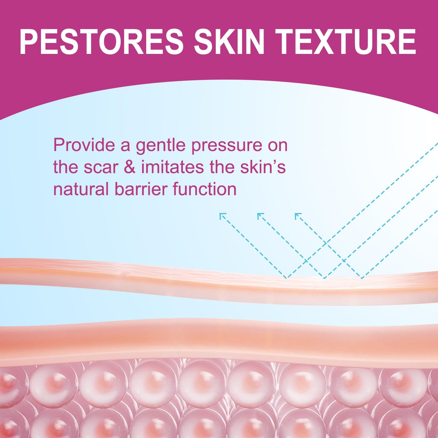 Vortexonix Silicone Scar Sheets | Medical-Grade Soft Silicone Tape (1.6” x 75” / 1.9m)