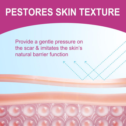 Vortexonix Silicone Scar Sheets | Medical-Grade Soft Silicone Tape (1.6” x 75” / 1.9m)