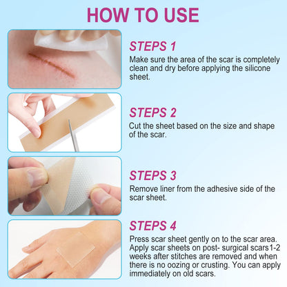 Vortexonix Silicone Scar Sheets | Medical-Grade Soft Silicone Tape (1.6” x 75” / 1.9m)