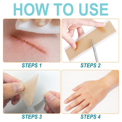 Vortexonix Silicone Scar Sheets – Medical-Grade Soft Silicone Scar Tape (1.6in x 150in, approx. 3.8m)