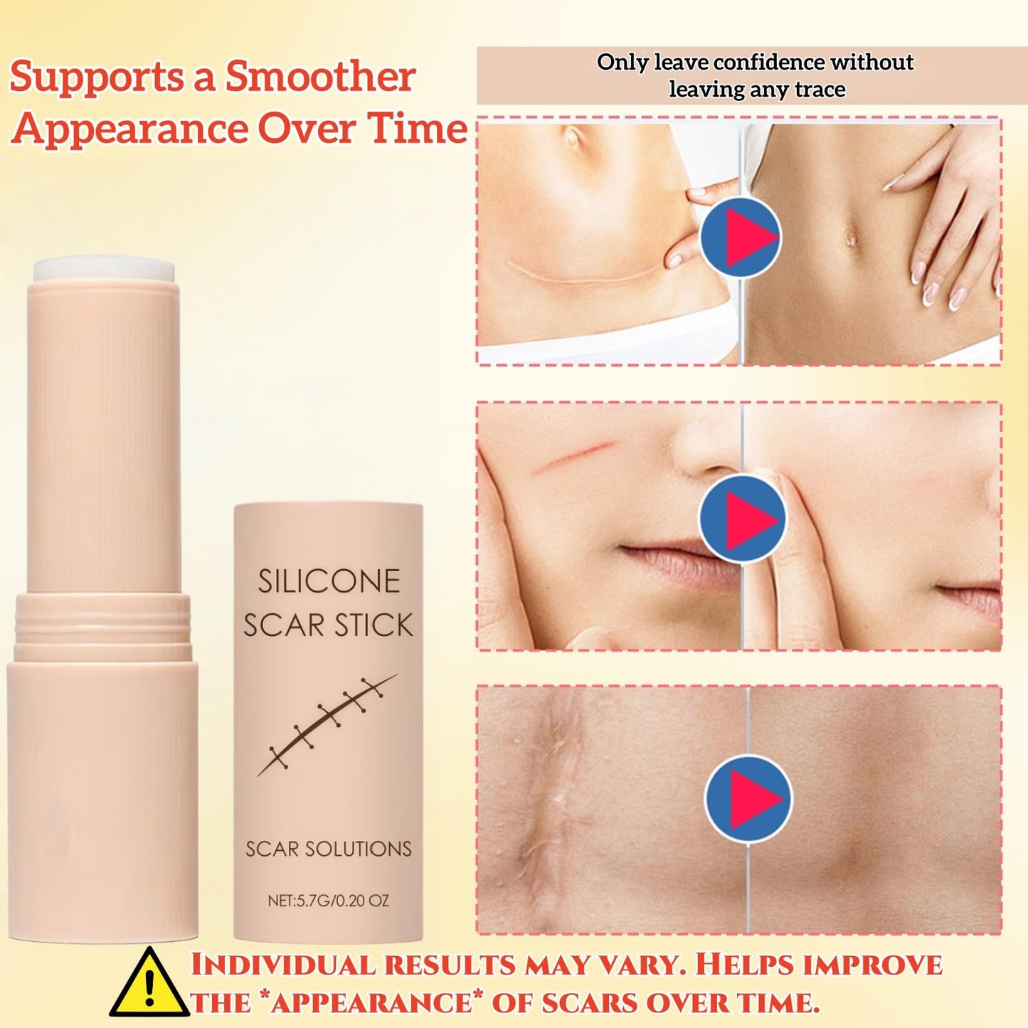 ZanDVRum Scar Solutions Silicone Scar Stick – Lightweight, Quick-Apply Scar Care (0.2 oz)