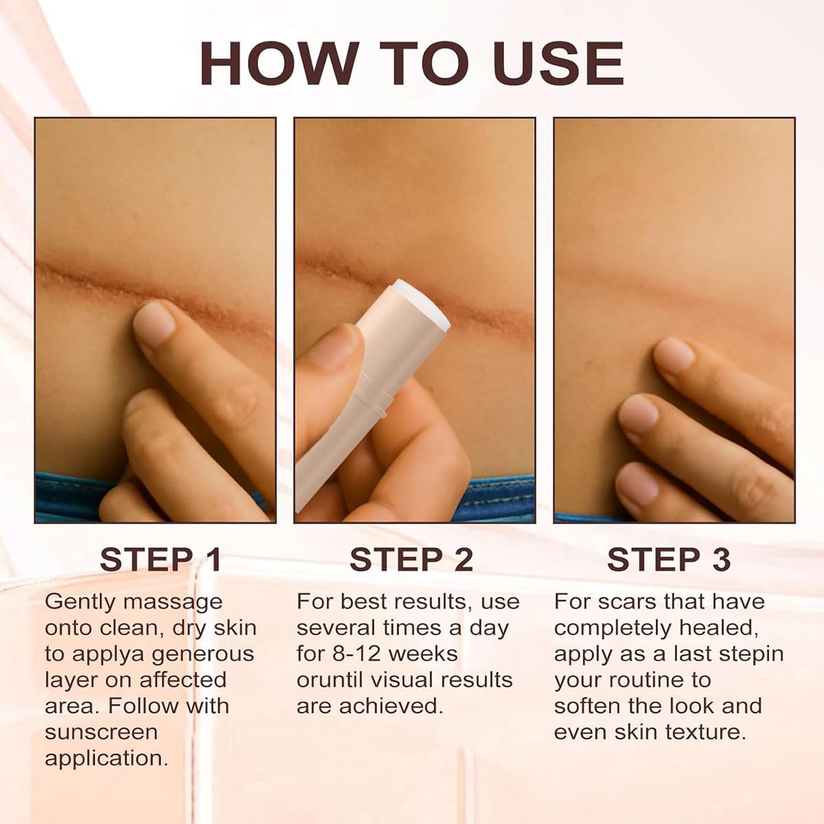 ZanDVRum Scar Solutions Silicone Scar Stick – Lightweight, Quick-Apply Scar Care (0.2 oz)