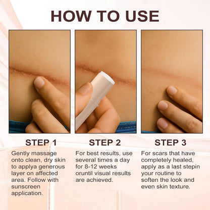ZanDVRum Scar Solutions Silicone Scar Stick – Lightweight, Quick-Apply Scar Care (0.2 oz)